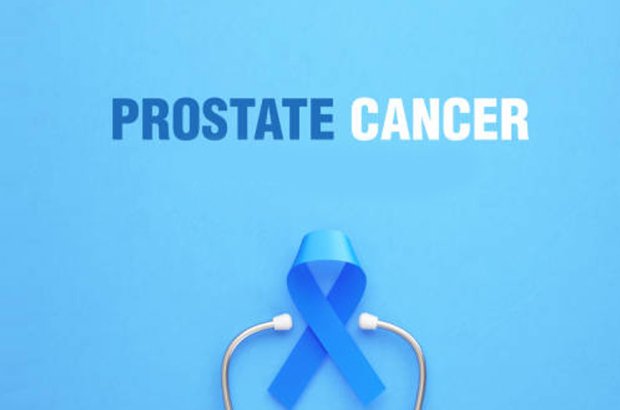 Reconsidering Prostate Cancer Screening and The Case for Early Testing in High-Risk Men