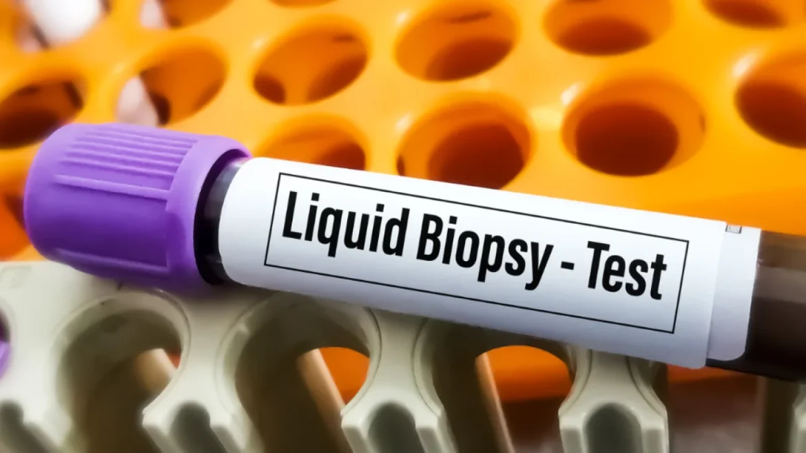 Liquid biopsy cancer test